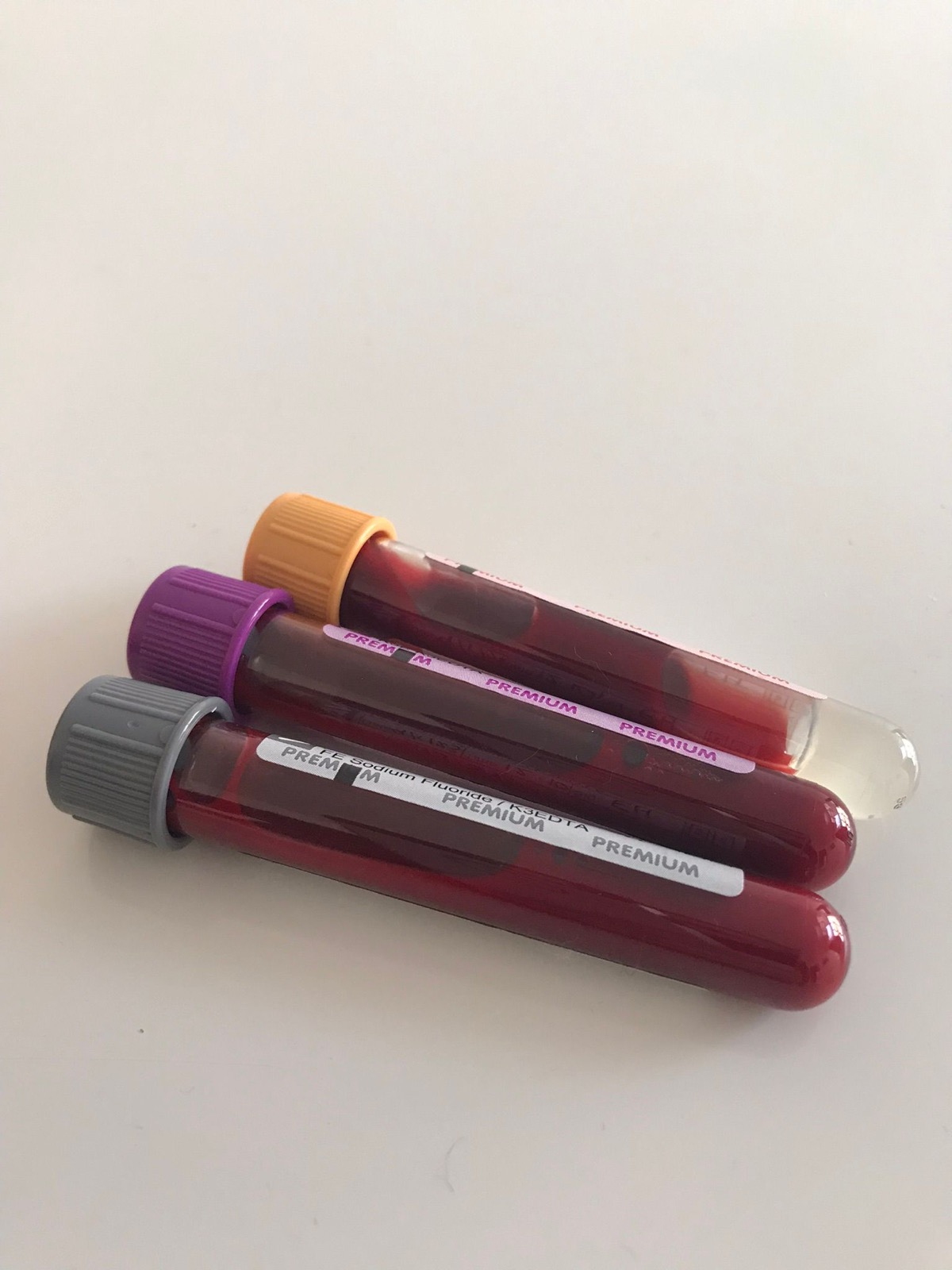 Lipid Profile at Mirror Image Clinic